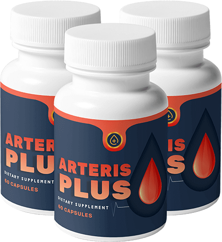 Arteris Plus